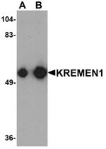 KREMEN1 Antibody in Western Blot (WB)