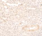 SDPR Polyclonal Antibody