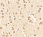 NUCB2 Polyclonal Antibody