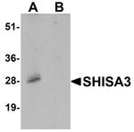 SHISA3 Antibody in Western Blot (WB)