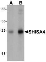 SHISA4 Antibody in Western Blot (WB)