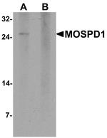 MOSPD1 Antibody in Western Blot (WB)