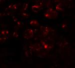 MTERFD1 Antibody in Immunocytochemistry (ICC/IF)