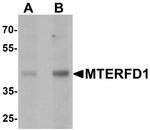 MTERFD1 Antibody in Western Blot (WB)