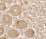 MTERFD2 Polyclonal Antibody