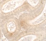 MTERFD3 Polyclonal Antibody
