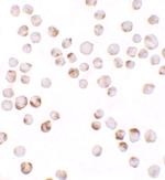 TIAF1 Polyclonal Antibody