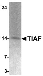 TIAF1 Antibody in Western Blot (WB)