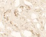 KANK2 Polyclonal Antibody