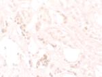 KANK3 Polyclonal Antibody