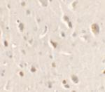 ULK1 Polyclonal Antibody