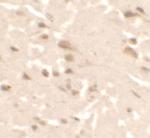 ULK2 Polyclonal Antibody
