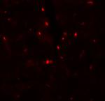 SLC27A6 Polyclonal Antibody