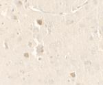 CISD2 Polyclonal Antibody