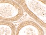 DIS3 Polyclonal Antibody
