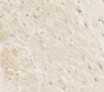 DDX41 Polyclonal Antibody