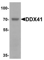 DDX41 Antibody in Western Blot (WB)