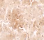 RNF20 Polyclonal Antibody