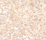 TLX1 Polyclonal Antibody