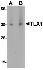 TLX1 Antibody in Western Blot (WB)