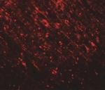 TLX2 Antibody in Immunohistochemistry (IHC)