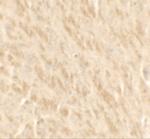 TLX2 Polyclonal Antibody