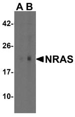 N-Ras Polyclonal Antibody