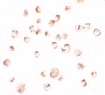 TRIM24 Polyclonal Antibody