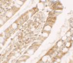 LPIN1 Polyclonal Antibody