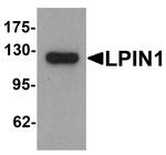 LPIN1 Antibody in Western Blot (WB)