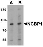 NCBP1 Antibody in Western Blot (WB)