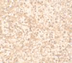 IL17RA Polyclonal Antibody