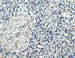 IL17RA Antibody in Immunohistochemistry (IHC)