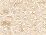 TFPI Polyclonal Antibody