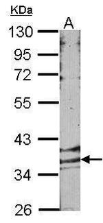 GPR146 Antibody in Western Blot (WB)