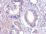 LTB4R Polyclonal Antibody