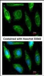 ALDH1A1 Polyclonal Antibody