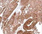 ALDH1A1 Antibody in Immunohistochemistry (Paraffin) (IHC (P))