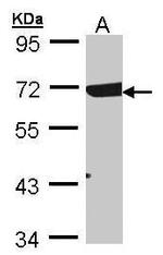 RAD17 Antibody in Western Blot (WB)