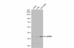 GPR91 Antibody in Western Blot (WB)