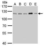 CYLD Polyclonal Antibody