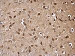 DDB1 Antibody in Immunohistochemistry (Paraffin) (IHC (P))