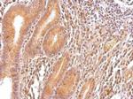 K-Ras Antibody in Immunohistochemistry (Paraffin) (IHC (P))