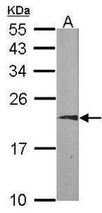 K-Ras Antibody in Western Blot (WB)