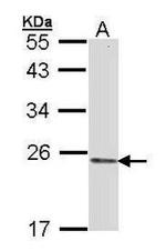K-Ras Antibody in Western Blot (WB)
