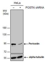 Periostin Antibody in Western Blot (WB)