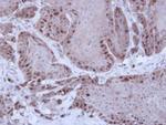 RAD51 Antibody in Immunohistochemistry (Paraffin) (IHC (P))