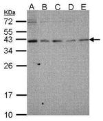 RAD51 Antibody in Western Blot (WB)