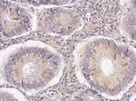 MMP14 Antibody in Immunohistochemistry (Paraffin) (IHC (P))