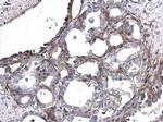 MMP14 Antibody in Immunohistochemistry (Paraffin) (IHC (P))
